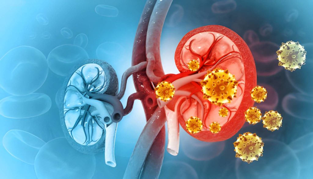 Concept de maladie rénale