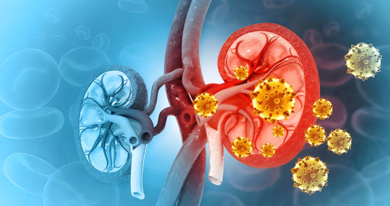 Concept de maladie rénale