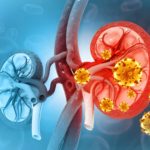 Concept de maladie rénale